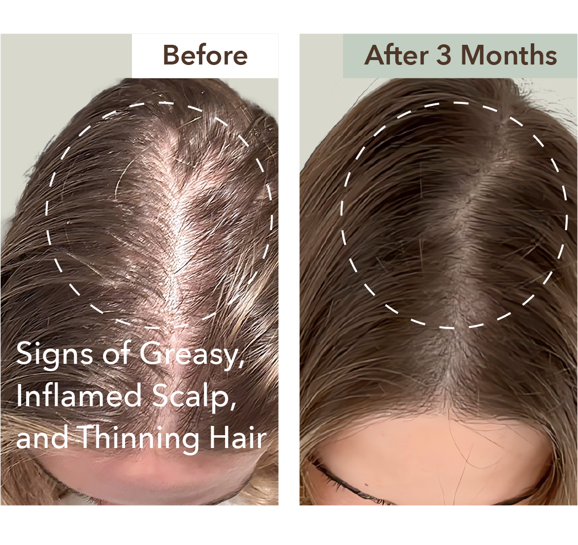 HALF COURSE SCALP RELIEF & HAIR DENSITY SERUM