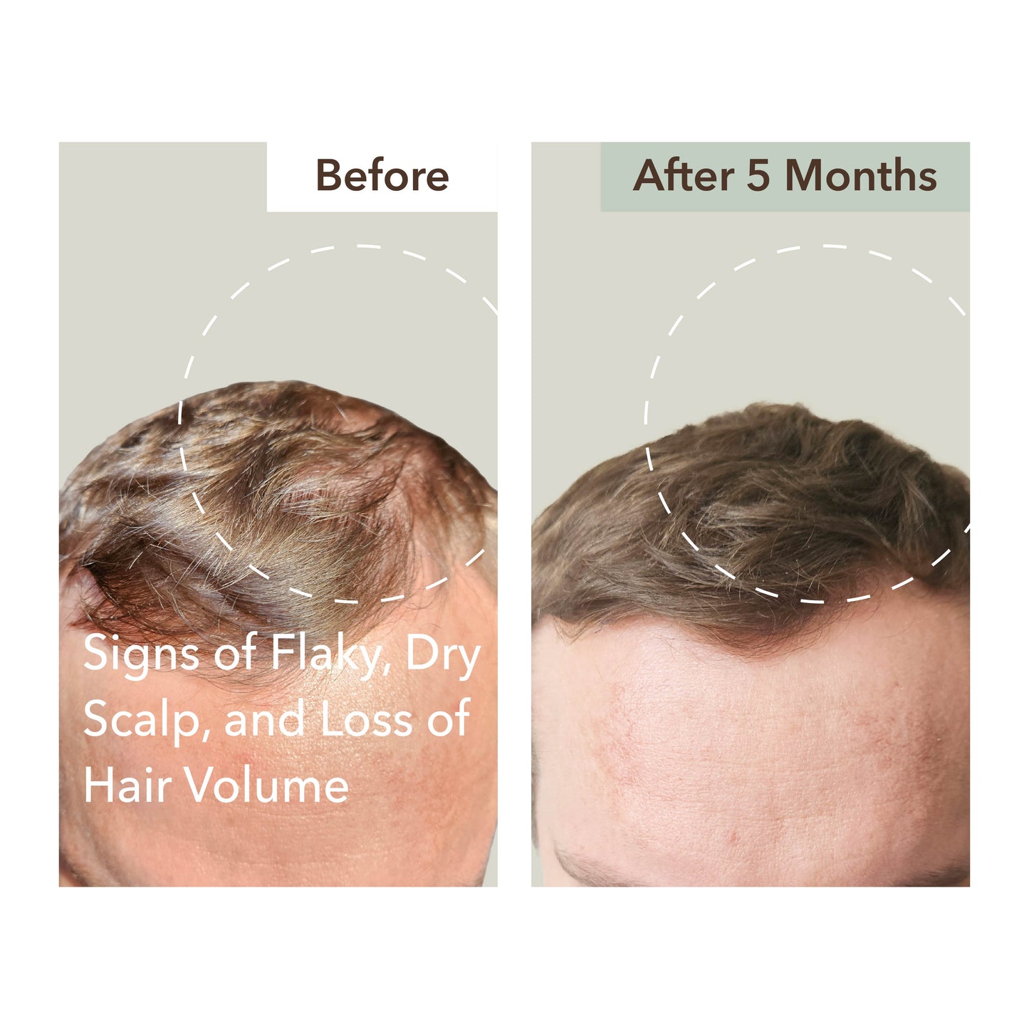 HALF COURSE SCALP RELIEF & HAIR DENSITY SERUM