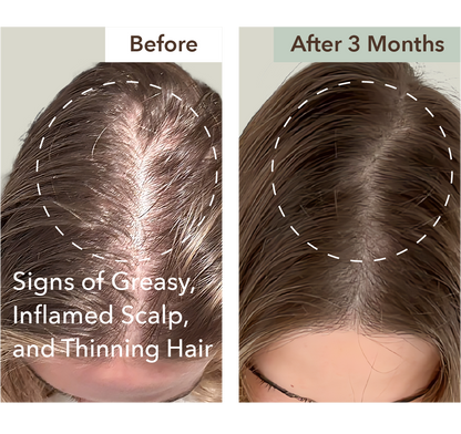 HALF COURSE SCALP RELIEF & HAIR DENSITY SERUM