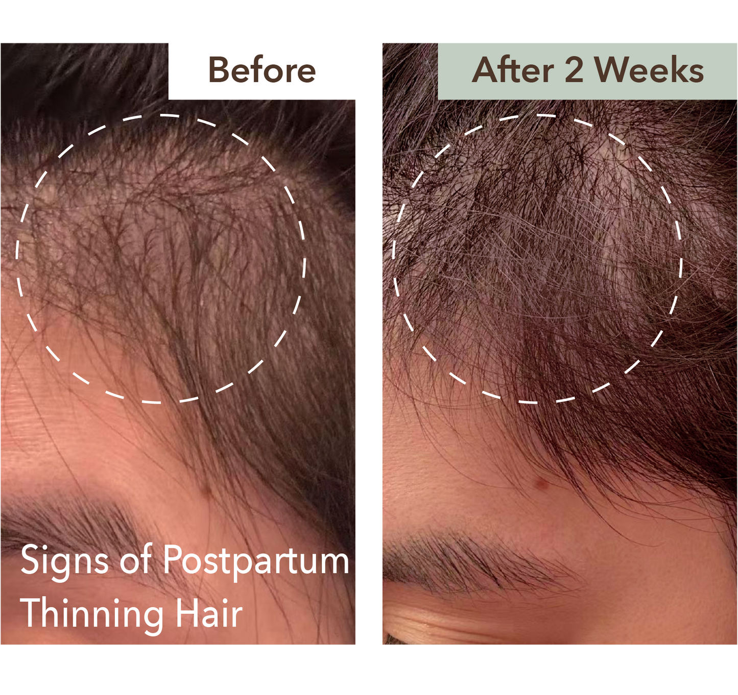 SCALP RELIEF & HAIR DENSITY SERUM