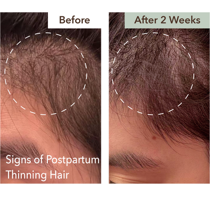 SCALP RELIEF & HAIR DENSITY SERUM