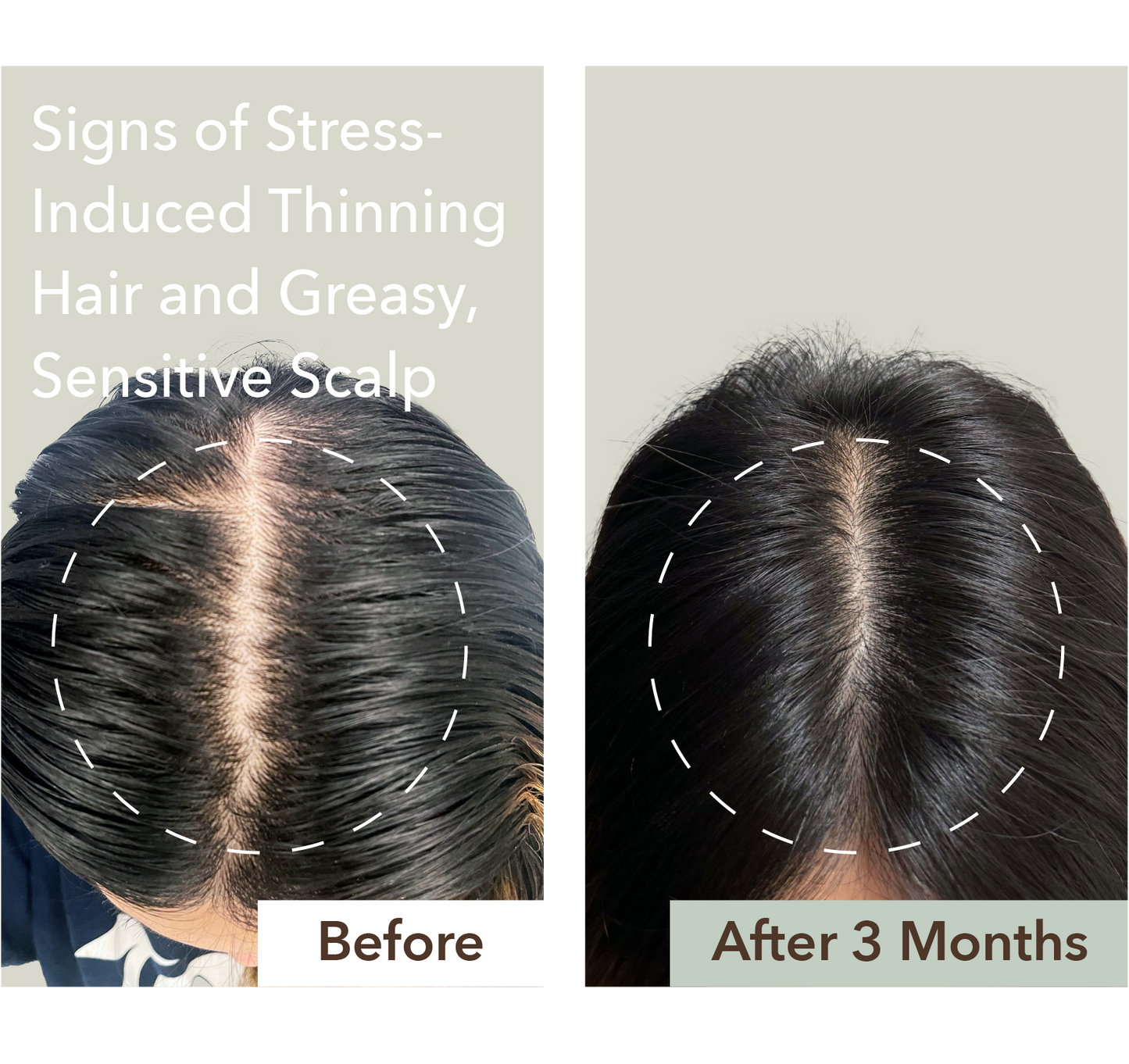 HALF COURSE SCALP RELIEF & HAIR DENSITY SERUM