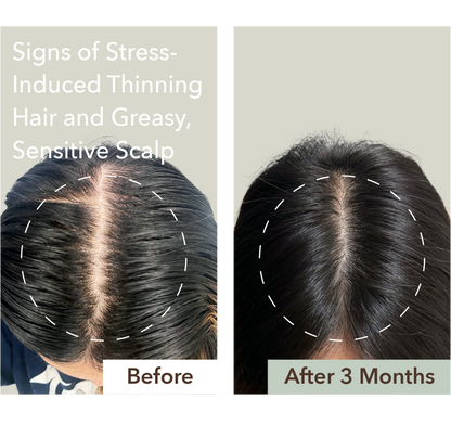 HALF COURSE SCALP RELIEF & HAIR DENSITY SERUM