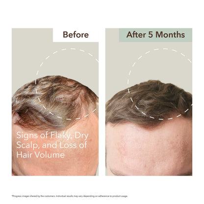 HALF COURSE SCALP RELIEF & HAIR DENSITY SERUM