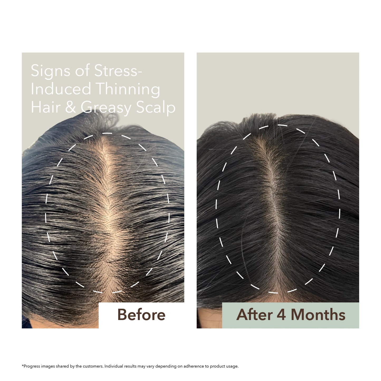 HALF COURSE SCALP RELIEF & HAIR DENSITY SERUM