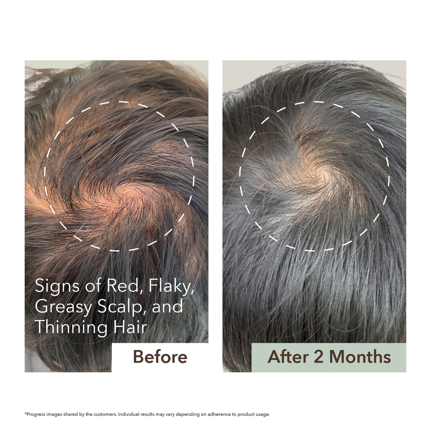 SCALP RELIEF & HAIR DENSITY SERUM