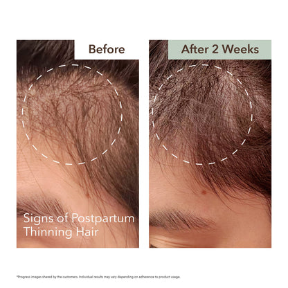 SCALP RELIEF & HAIR DENSITY SERUM