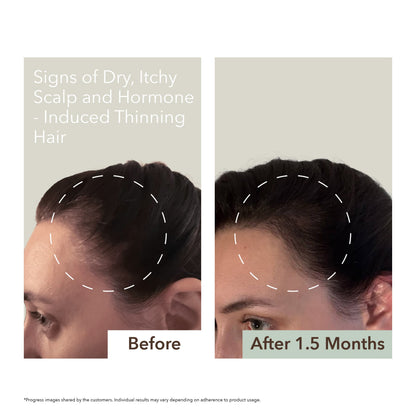 SCALP RELIEF & HAIR DENSITY SERUM