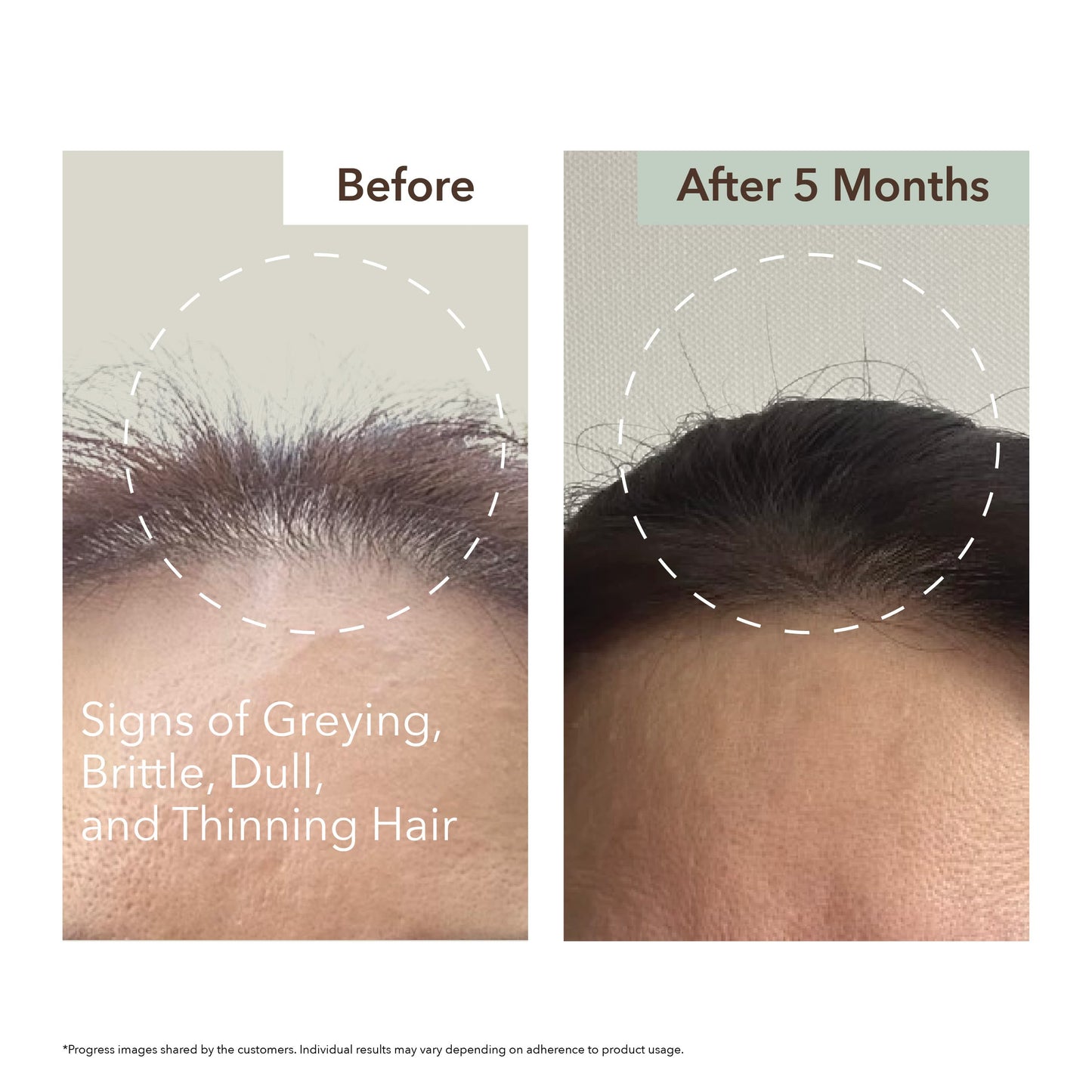 HALF COURSE SCALP RELIEF & HAIR DENSITY SERUM