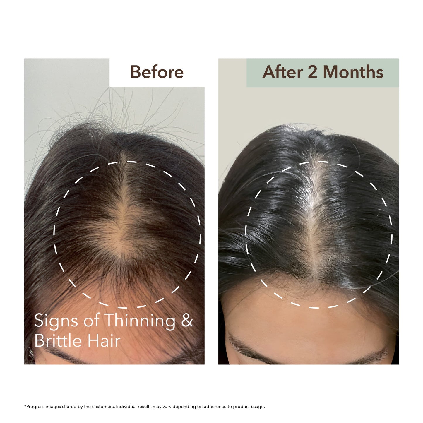 SCALP RELIEF & HAIR DENSITY SERUM