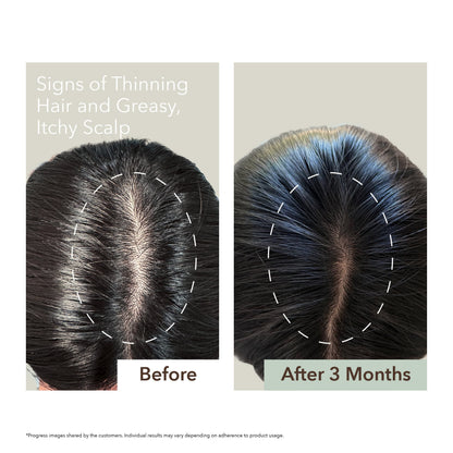 SCALP RELIEF & HAIR DENSITY SERUM