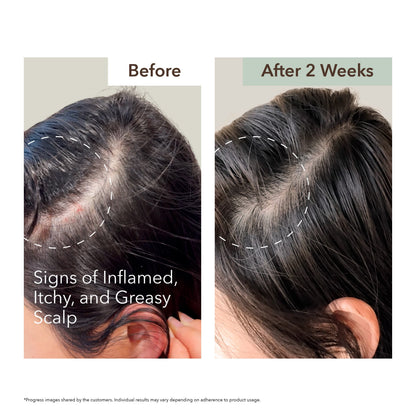 SCALP RELIEF & HAIR DENSITY SERUM