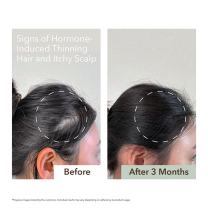 HALF COURSE SCALP RELIEF & HAIR DENSITY SERUM