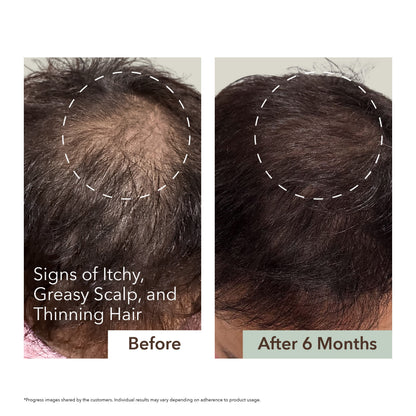 HALF COURSE SCALP RELIEF & HAIR DENSITY SERUM
