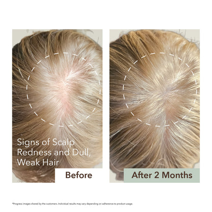 SCALP RELIEF & HAIR DENSITY SERUM