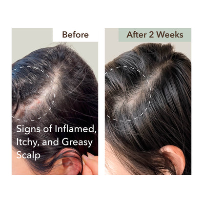 SCALP RELIEF & HAIR DENSITY SERUM