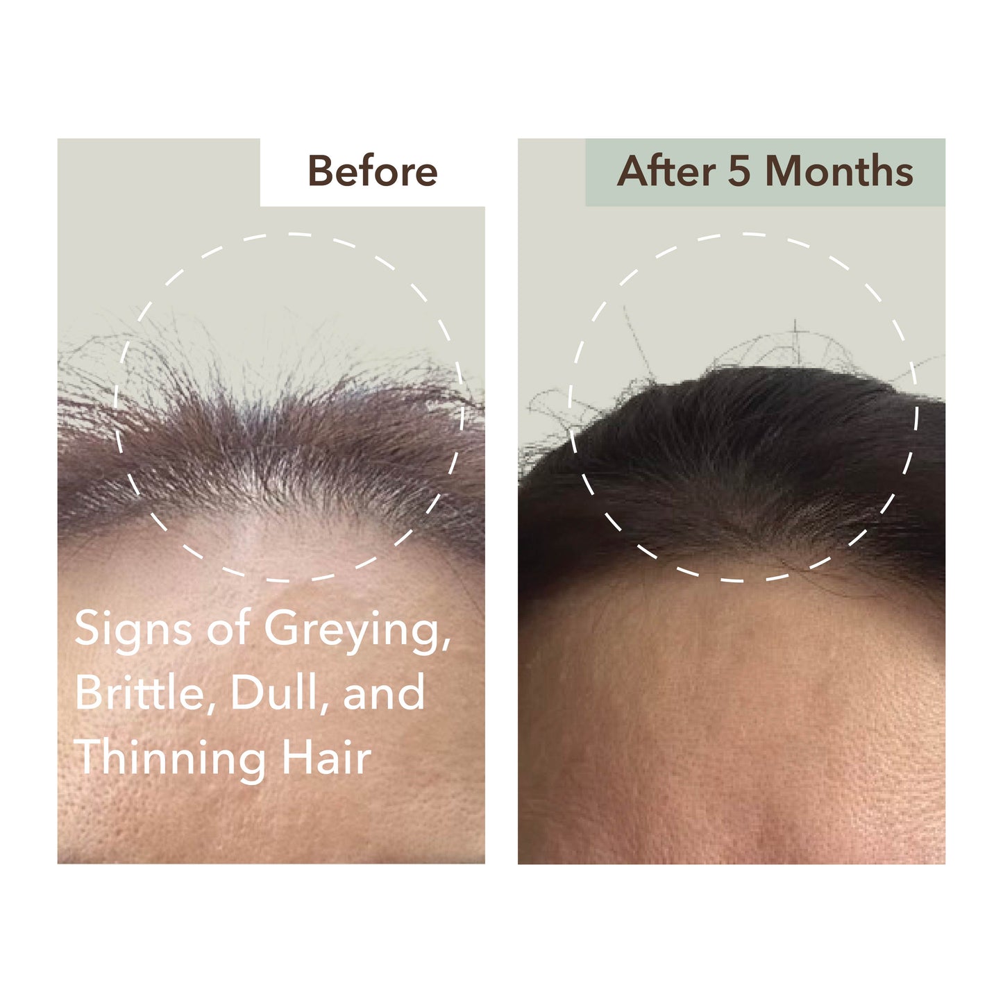 HALF COURSE SCALP RELIEF & HAIR DENSITY SERUM
