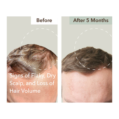 HALF COURSE SCALP RELIEF & HAIR DENSITY SERUM