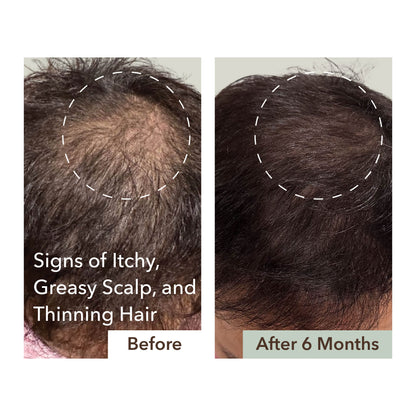 HALF COURSE SCALP RELIEF & HAIR DENSITY SERUM