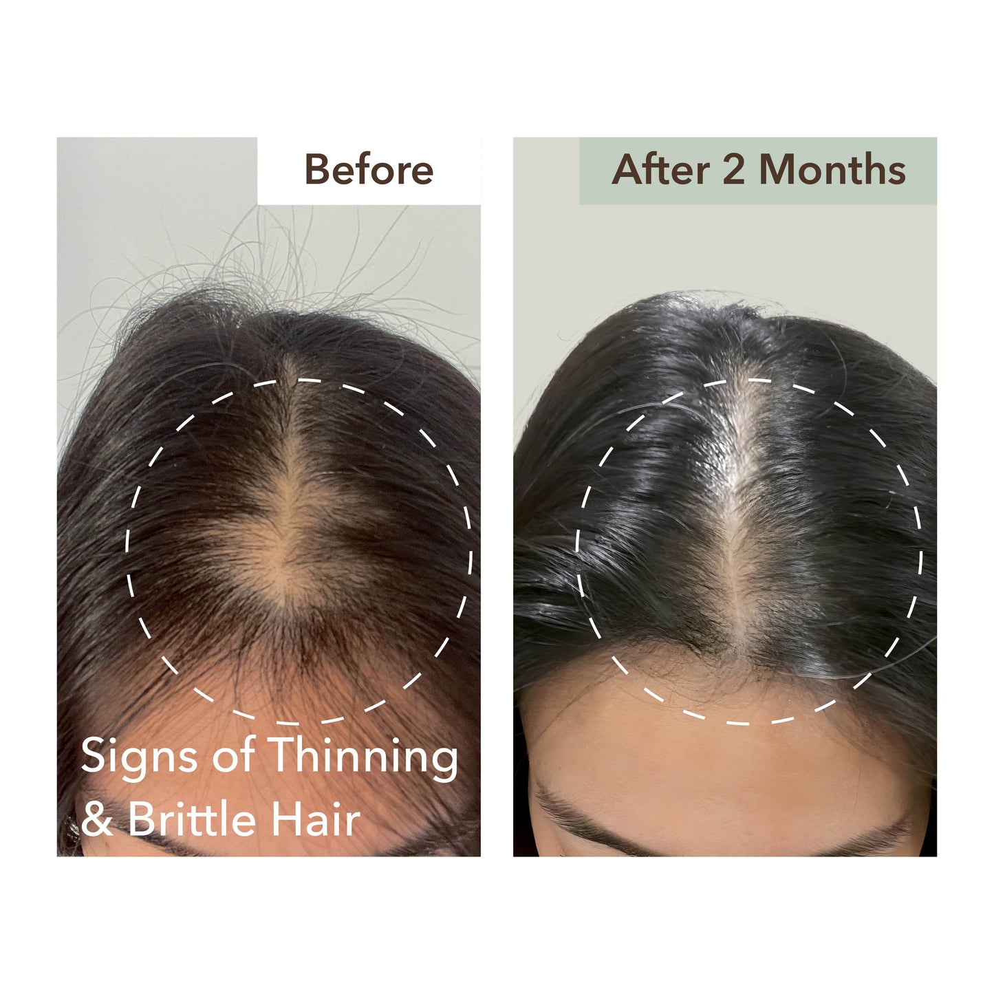 SCALP RELIEF & HAIR DENSITY SERUM