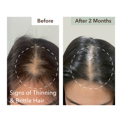 SCALP RELIEF & HAIR DENSITY SERUM