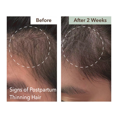 SCALP RELIEF & HAIR DENSITY SERUM
