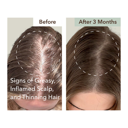 HALF COURSE SCALP RELIEF & HAIR DENSITY SERUM