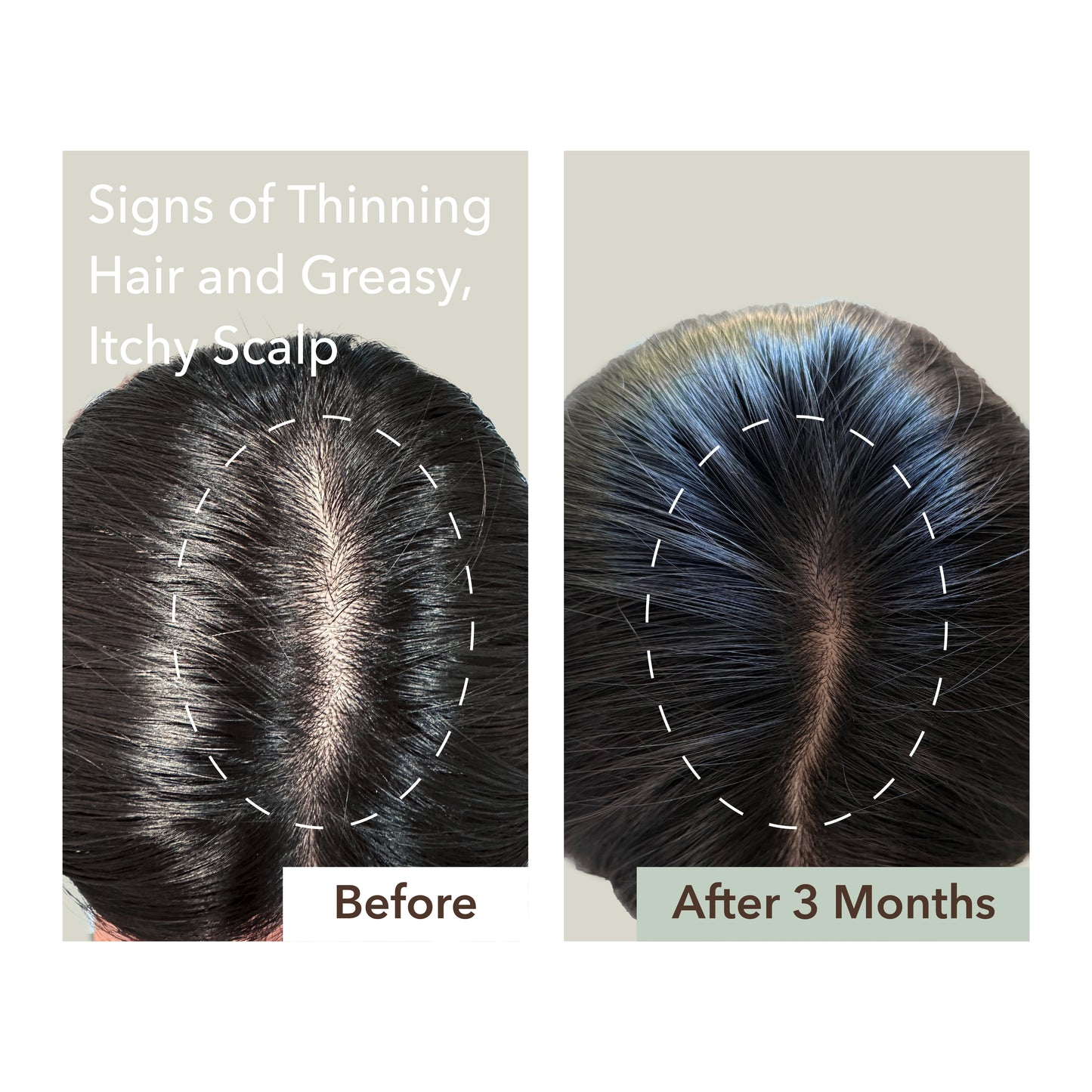SCALP RELIEF & HAIR DENSITY SERUM