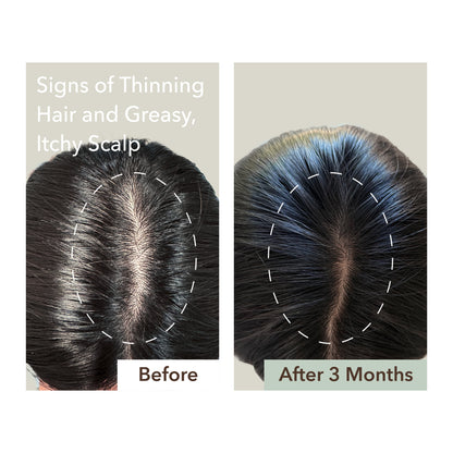 SCALP RELIEF & HAIR DENSITY SERUM
