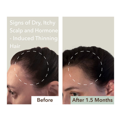 SCALP RELIEF & HAIR DENSITY SERUM