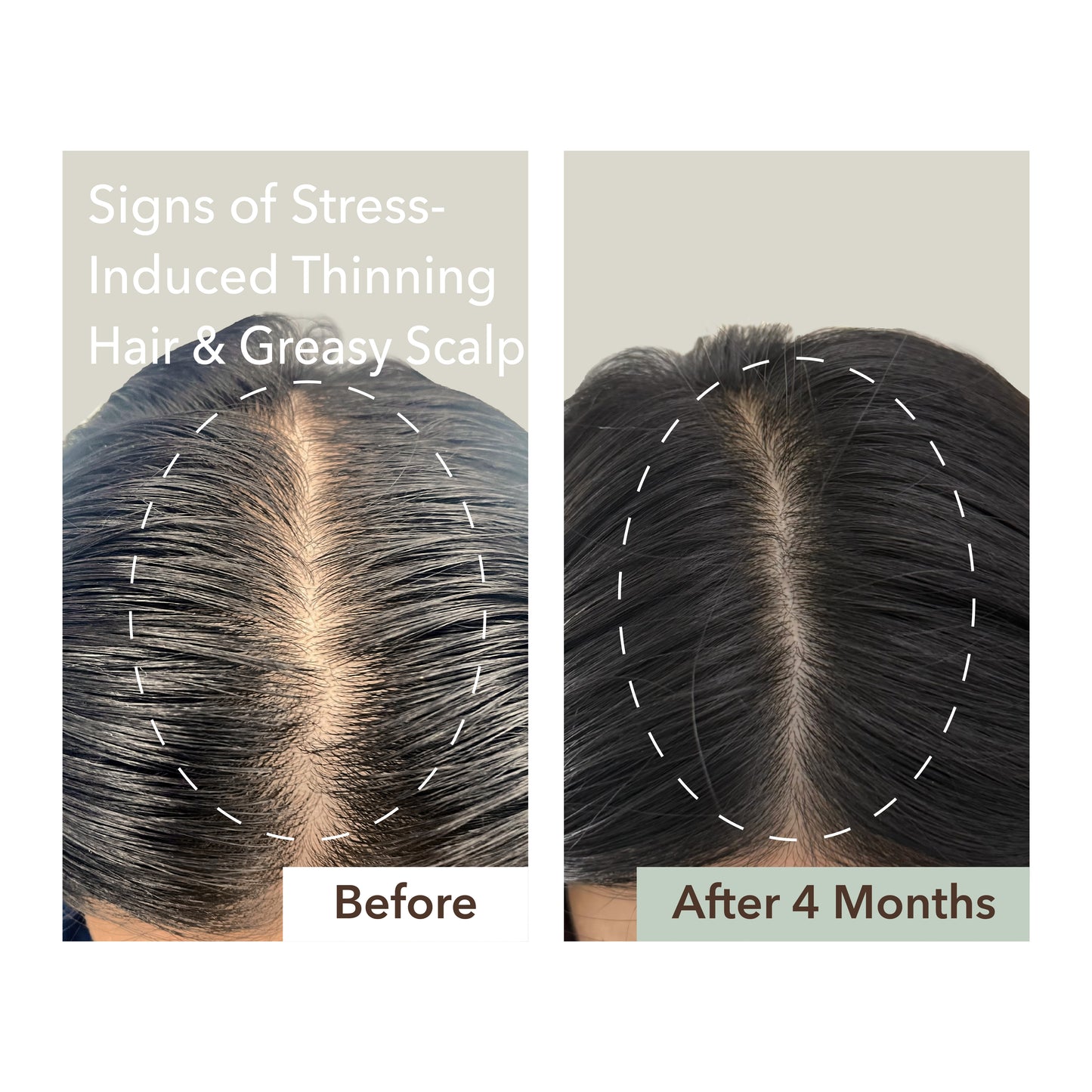 HALF COURSE SCALP RELIEF & HAIR DENSITY SERUM