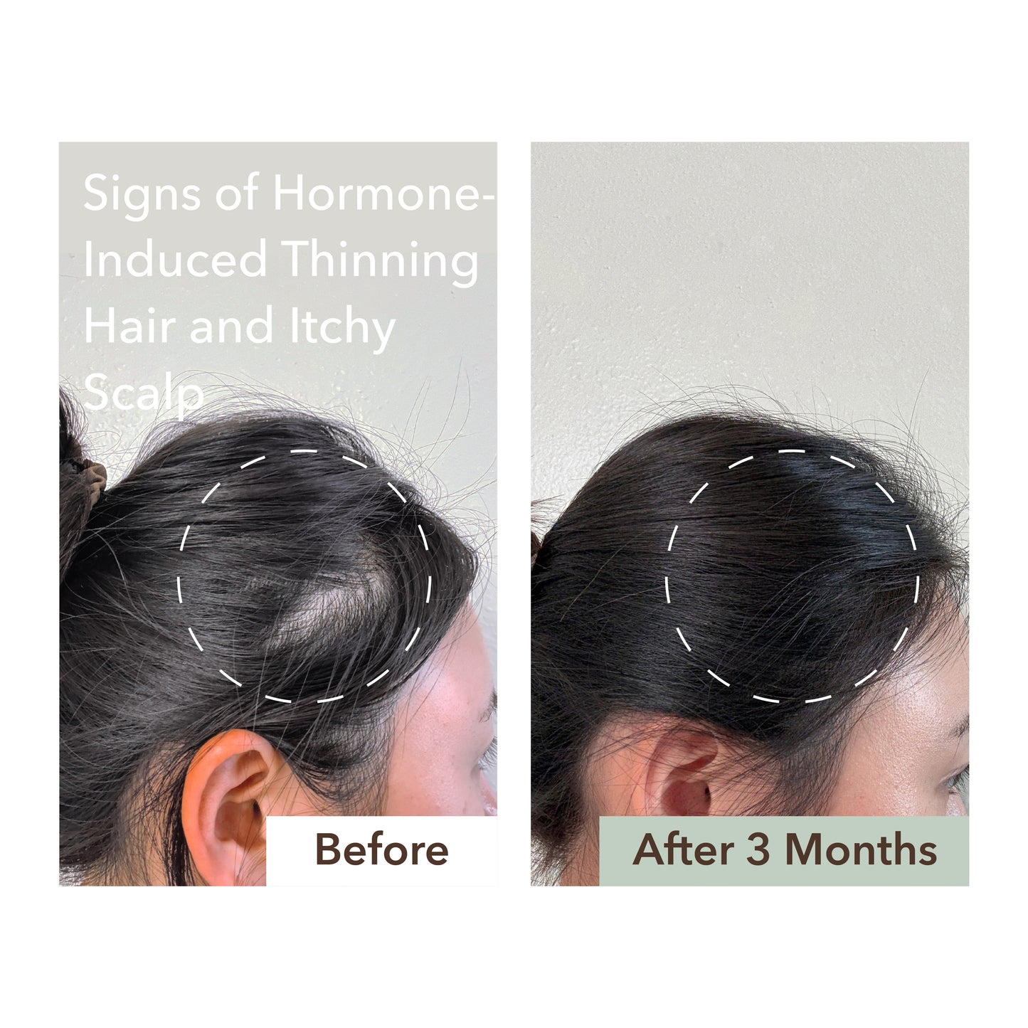 HALF COURSE SCALP RELIEF & HAIR DENSITY SERUM