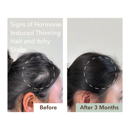 HALF COURSE SCALP RELIEF & HAIR DENSITY SERUM